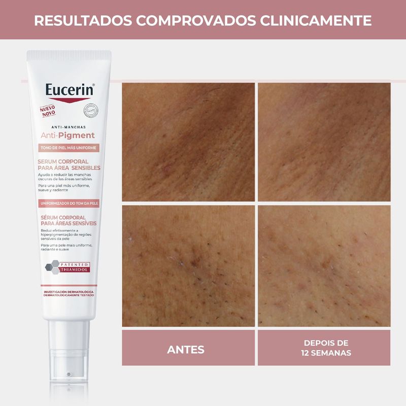 4006000014401-Eucerin_Anti_Pigment_S_rum_Corporal_reas_Sens_veis_75ml-Body-Eucerin_--9-